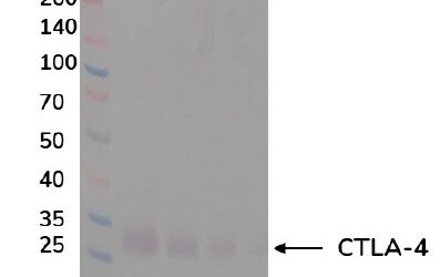 Human Anti-CTLA-4